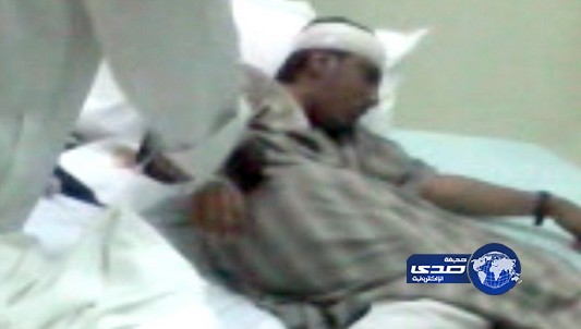 كسر جمجمة شاب في مضاربة بين 25 شخصاً في مستشفى تربة
