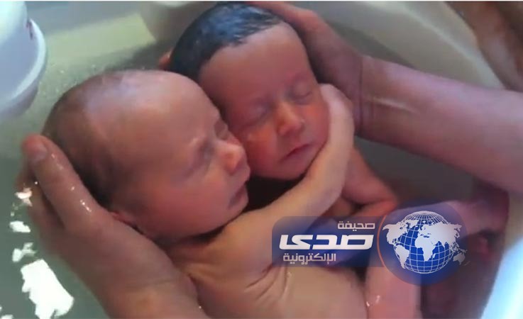 بالفيديو: توأم يعانق أحدهما الآخر يجذب الملايين في أسبوع