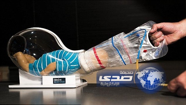 “ميكانيكي سيارات”.. يخترع جهازا للولادات العسيرة