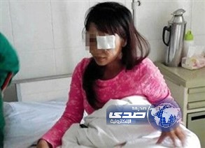صيني ينتزع عين زوجته.. من الغيرة