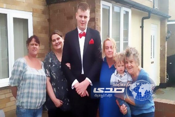 حالة مرضية فريدة.. فتى يزداد طوله 2.5 سنتيمترا أسبوعيا