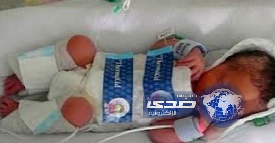 تجميد مولود بريطانى لإنقاذ حياته