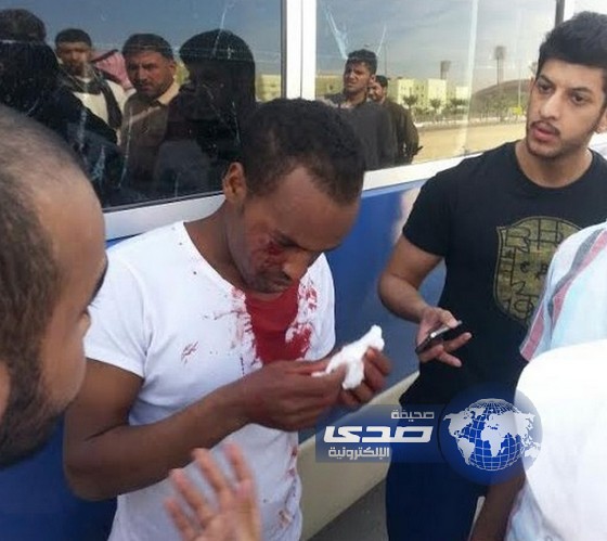 بالصور: تعرض سائق نقل طالبات جامعة الامام للضرب صباح اليوم امام زوجته وأبنته