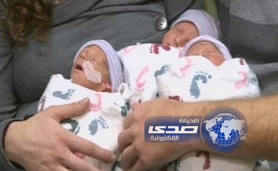 ولادة نادرة جدا لثلاثة توائم متطابقين