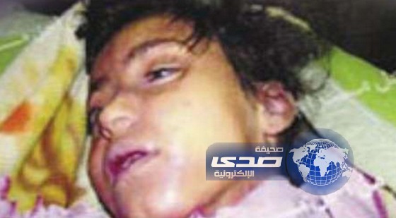 تأييد حكم بالإعدام لمغتصبي وقاتلي طفلة يمنية لم تتجاوز الـ7 أعوام