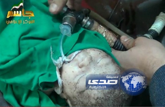 بالفيديو :  صواريخ النظام السوري تُخرج جنيناً «حياً» من بطن أمه