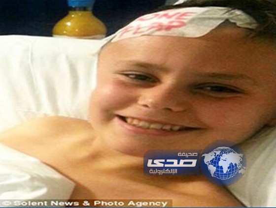 أطباء يضعون عظام جمجمة طفل في معدته