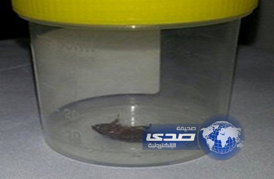 إخراج صرصار طوله سنتيمتران من أذن رجل!