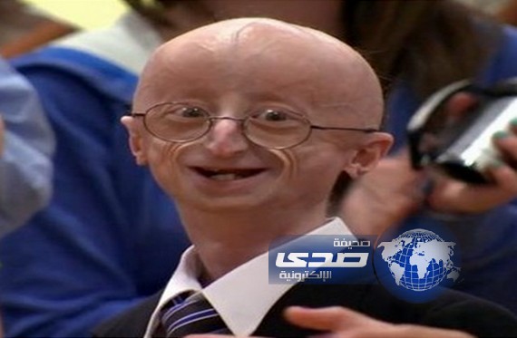 وفاة شاب 17 عاماً بسبب الشيخوخة المبكرة