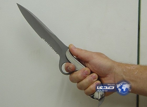 فرنسي قطع إصبع زوجته أثناء شجار على برنامج تلفزيوني!