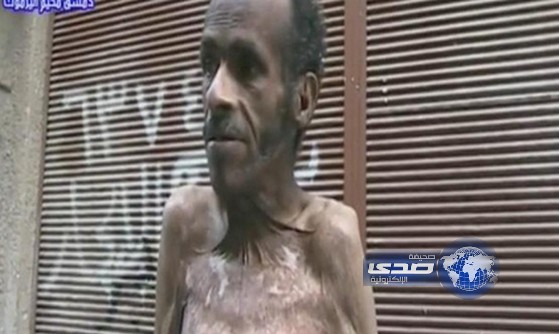بالفيديو .. شهادات صادمة لسوري حي &#8220;ميّت من الجوع&#8221; باليرموك