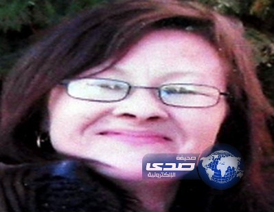 كلبة تأكل وجه خمسينية فتفقدها القدرة على الإبصار – صورة