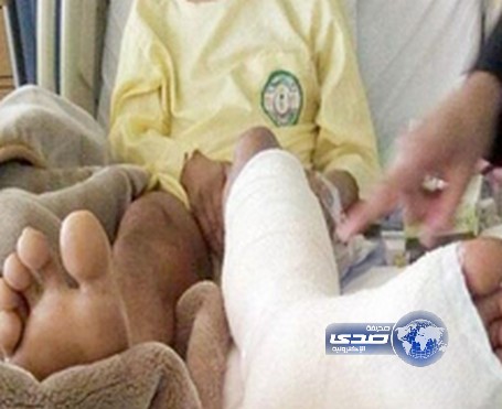 مواطن يتهم مستشفى بارتكاب خطأ طبي سبب له آلاما مبرحة ساق