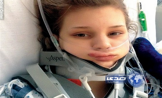 نجاة مراهقة بأعجوبة بعد سقوطها أثناء ممارسة القفز بالمظلات