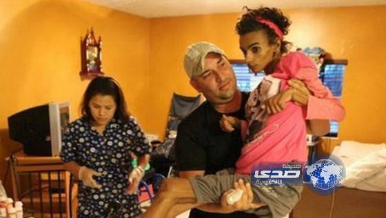 جراحة تجميلية تحول امرأة بريطانية إلى معاقة جسدياً