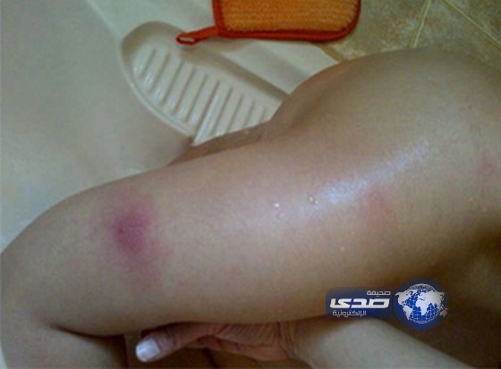 الشرطة تستدعى “أب” عنف أبنته في الدرب