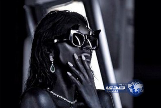 صورة تظهر ” مايا دياب” محروقة