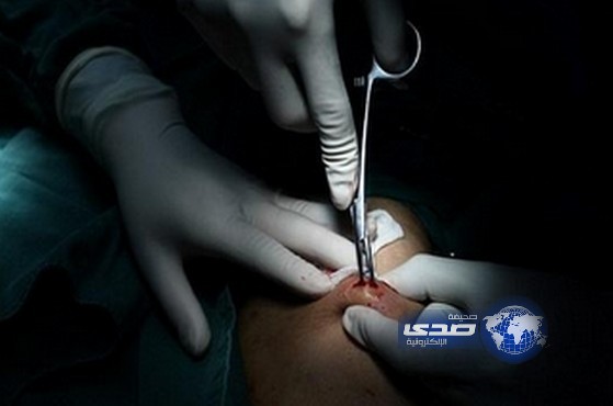 بالصور..استخراج 42 لؤلؤة من جسم مريض
