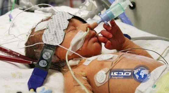 طبيب إيراني يعارض علماء الشيعة بحق الموت الرحيم لمرضى المسلمين