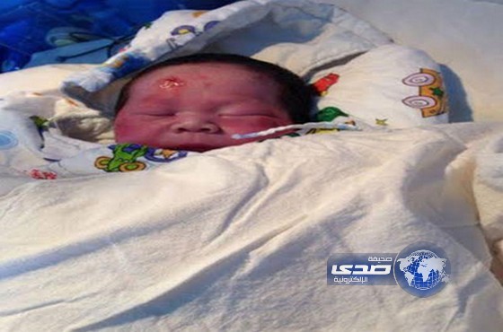 طفل يخرج من رحم أمه سليماً على الطريق عقب حادث أودى بحياتها