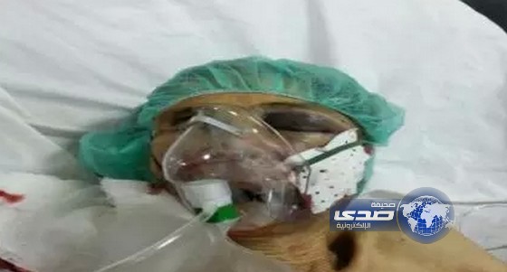 نقل سبعينية للمستشفى بعد تعرضها لمحاولة اغتصاب