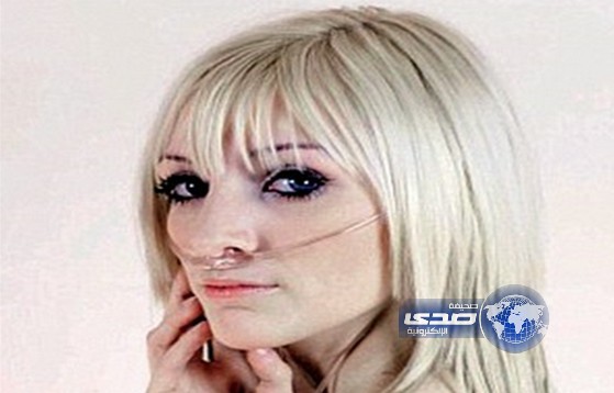 التليف الكيسي يقضي على وجه دعائي