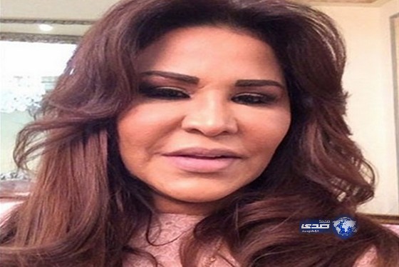 الصورة التي صدمت معجبي أحلام وأبرزت مساوئ عملياتها التجميلية