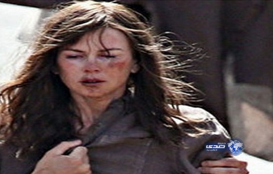 نيكول كيدمان تظهر في حالة مزرية!