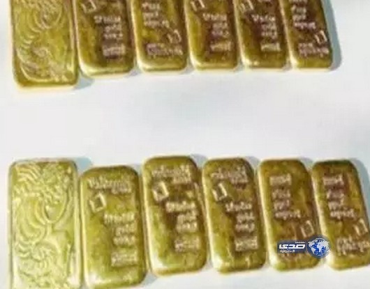 أطباء هنود يخرجون 12 قطعة ذهب صغيرة من أمعاء رجل أعمال