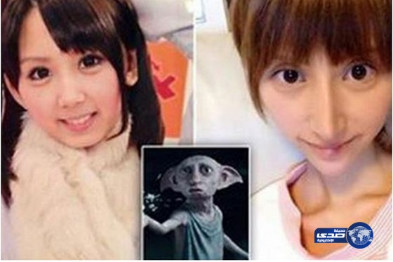 يابانية جميلة أجرت عمليات تجميل لتتحول إلى قزم هاري بوتر