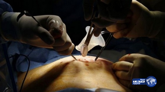 اندلاع النيران في معدة مريض أثناء عملية جراحية!