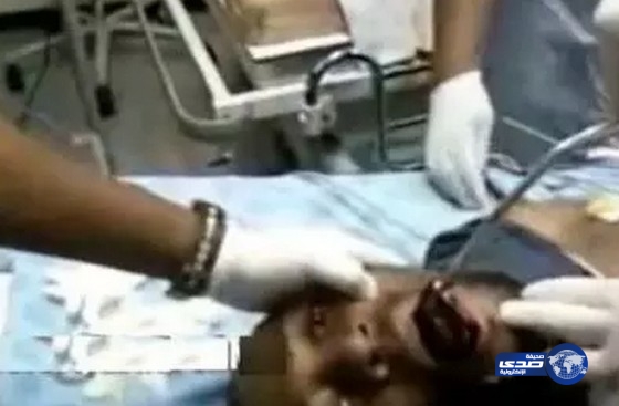 بالفيديو: هاتف جوال يعلق في حنجرة رجل أفريقي و الأطباء يسخرون
