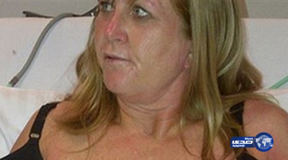 انفجار ثديي امرأة بعد عملية تكبير