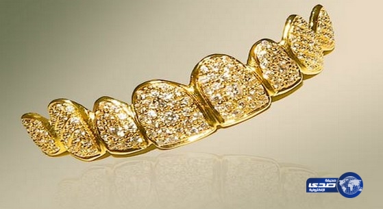 أغلى ابتسامة في العالم لقطرية مصنوعة من الذهب والألماس