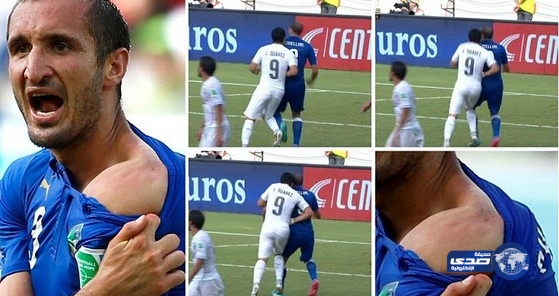 سواريز عن “عضة” جورجيو: أمور تحدث داخل منطقة الجزاء