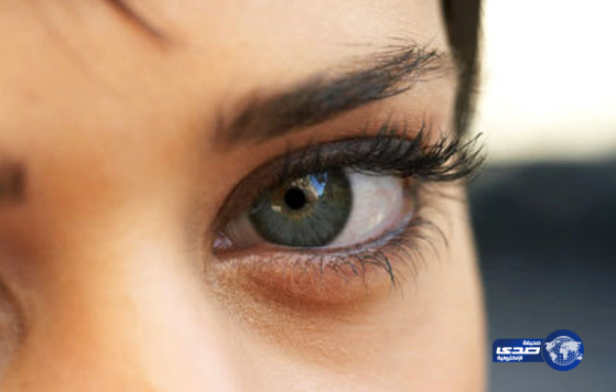 الصداع مؤشر على أمراض العيون