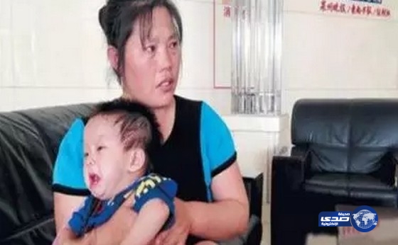 أم تهرب من المستشفى و تتخلى عن طفلها لأنه ولد بورم يماثل وزنه