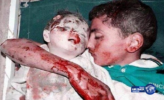 فنانة فلسطينية ترثي شهيدان توفيا وهما يحتضنان بعضهما