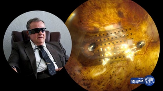 ابتكار جهاز يساعد الضرير على استعادة النظر