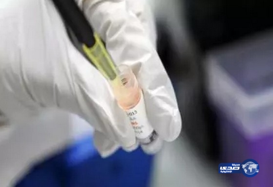 فيروس الإيدز يعود لطفلة شفيت منه بعد علاجها بمضادات