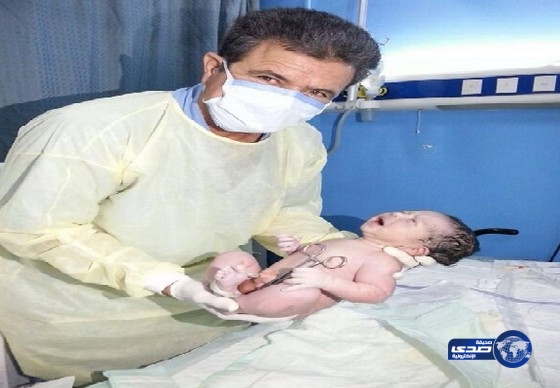 ولادة معتمرة باكستانية بمستشفى الملك عبدالعزيز بنجاح‎