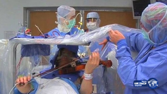 عازف كمان يعزف أثناء إجراء عملية في المخ