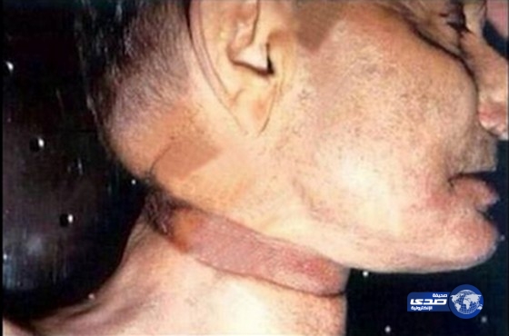 صورة جثة روبن ويليامز بعد انتحاره تثير الجدل