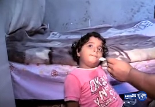 فيديو: في حالة نادرة طفلان يأكلان “اللحوم النية”