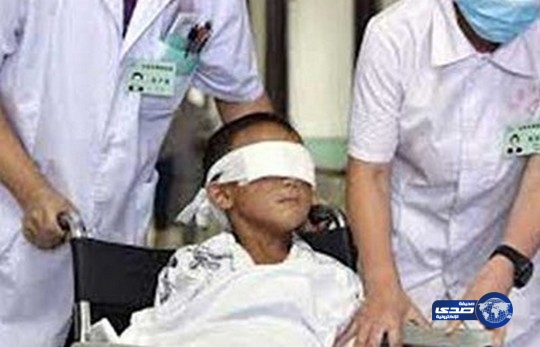 بالفيديو: ام تقتلع عينا طفلها بملعقة خشبية