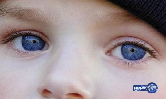 زوجان ضحّى كل منهما بعين.. ليبصر طفلهما