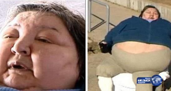 شركات طيران ترفض نقل إمراة بسبب سمنتها المفرطة