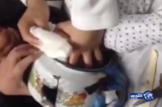 بالفيديو: لحظة تحرير رأس طفلة من داخل إبريق شاي