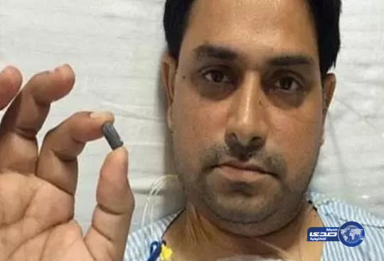 هندي لا يزال حيّاً رغم إصابته برصاصة في قلبه