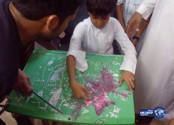 مدنى جازان ينقذ طالب احتجز اصبعه في طاولة دراسية بمدرسته (صور)